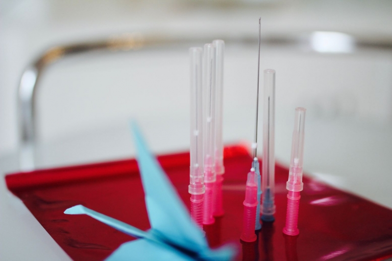 Lifting mit PDO Fäden zur Stabilisierung des Gewebes